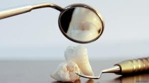 Grupos de periodoncistas