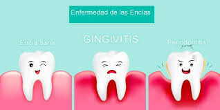 Comprobación de enfermedad no lineal