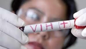Virus de Inmunodeficiencia Adquirida (VIH)