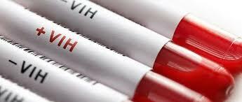 Virus de Inmunodeficiencia Adquirida (VIH)