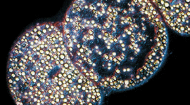 Timeline: Microbiología y su Historia