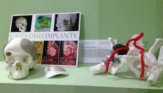 Prima biostampante 3D