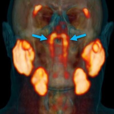Timeline: New glands