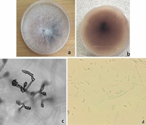 Causante de enfermedad bakanae
