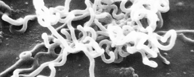 Noguchi y Moore 1913 dC.