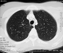 Época Independiente