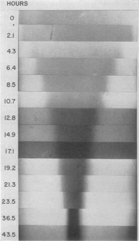 Matthew Meselson & Franklin Stahl