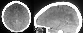 Implementación de programas