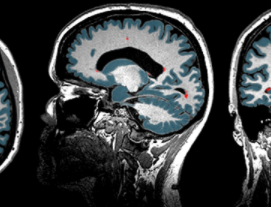 Imagenología Cerebral 1990