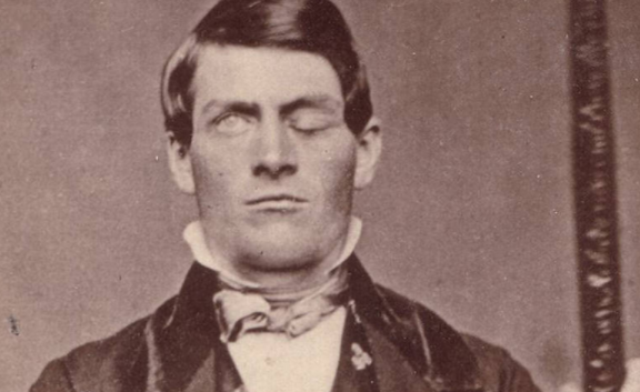 Caso Phineas Gage