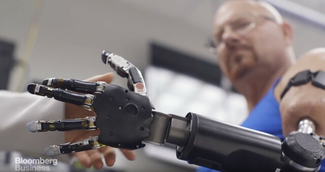 Primera prótesis robótica