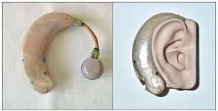 Transistor Hearing Aids Become More Widely Used