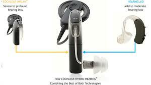 Cochlear Implant Hybrid Model