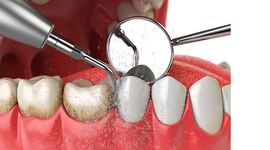 Timeline: HISTORIA DE LA PERIODONCIA