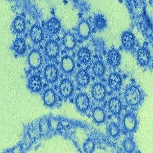 Influenza A Outbreak (H1N1)