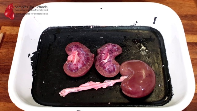 dissection