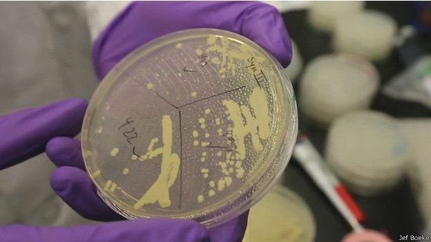 Se crea el cromosoma sintético partir de levadura