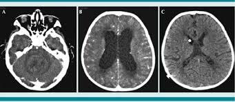 Periodo Contemporáneo (1975)