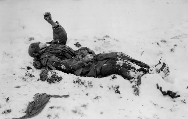 gets sent home due to injury