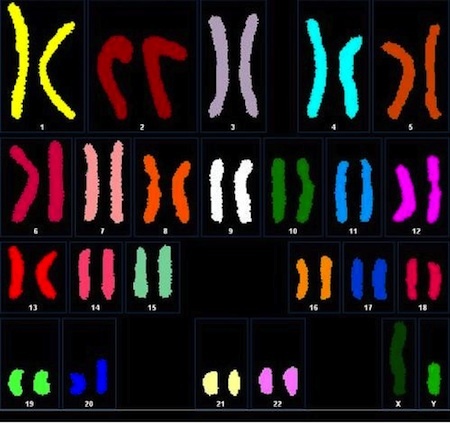 Human Genome is Sequenced (1990-2003)
