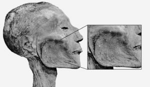 VIRUS DEL VAIOLO - ORIGINE