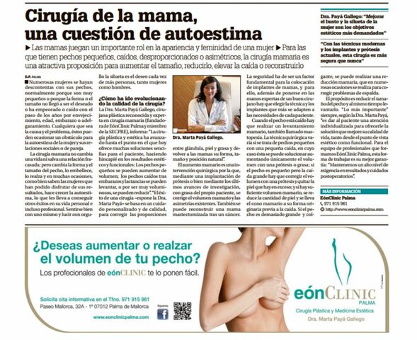 Nacimiento del publirreportaje