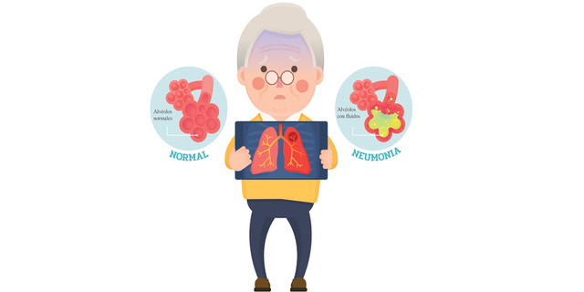 Unusual cases of pneumonia