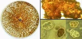 Woese y George E. Fox