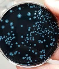 Legionella pneumophila
