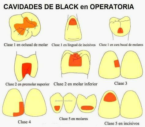 Primeros pasos en cavidades