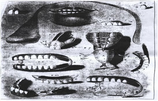 Técnica de construción de bases de prótesis