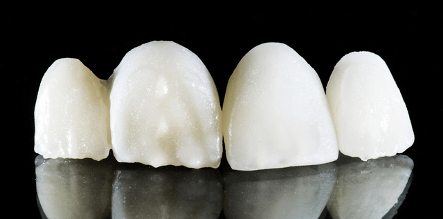 Restauraciones de cerámica sin metal