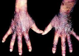 Álvaro Domínguez Peón (México)