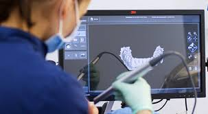 Comienzo siglo XX. Mejoras en calidad de materiales y procesos usados en Odontología Restauradora, también aplicación de pruebas físicas y mecánicas con fundamento de ciencia de ingeniería a diseños de estructuras y materiales de restauración