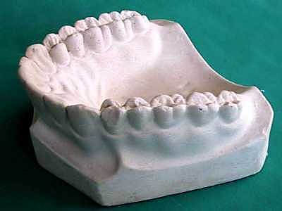 Restauración de dientes posteriores
