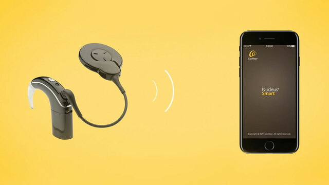 Cochlear created the ‘Nucleus 7’ that connects to a phone application, allowing CI users to control and monitor their implant. Also, individuals can connect their CI via Bluetooth to other devices (Hearing Health and Technology Matters, 2020).