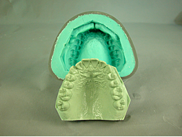 Hidrocoloide reversible en odontología