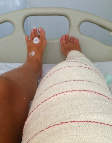 Accident HAPENS TO DRAKE