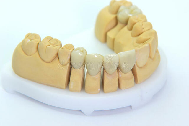 primer uso de porcelana