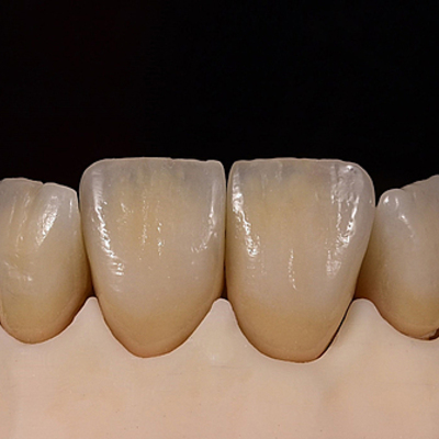 Timeline: Evolución de Odontología Restauradora hasta la Actualidad
