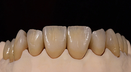 Timeline: Evolución de Odontología Restauradora hasta la Actualidad