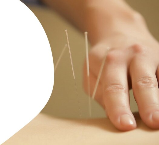 Acupuntura 2800 A.C