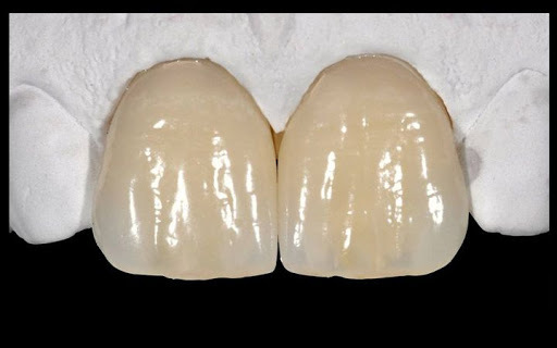 PRIMER MATERIAL DENTAL DE PORCELANA