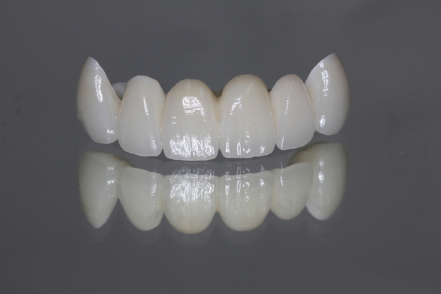 TECNICA CON DIENTES DE PORCELANA