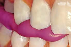 Se describió el método para impresiones con cera