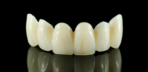Ceramica dental