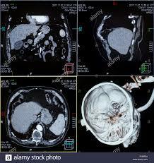 Incorporación y difusión de las técnicas imagenológicas contemporánea
