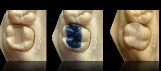 Técnica de cera perdida