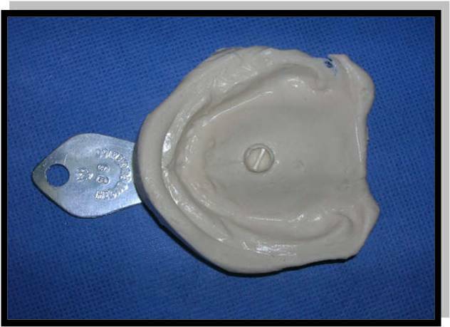 Hidrocoloide reversible