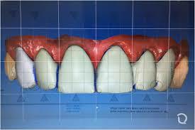 Introducción de asistido por computadora diseño